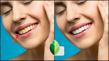 How to Whiten teeth in snapseed | how to whiten teeth in android | whiten teeth photo editing