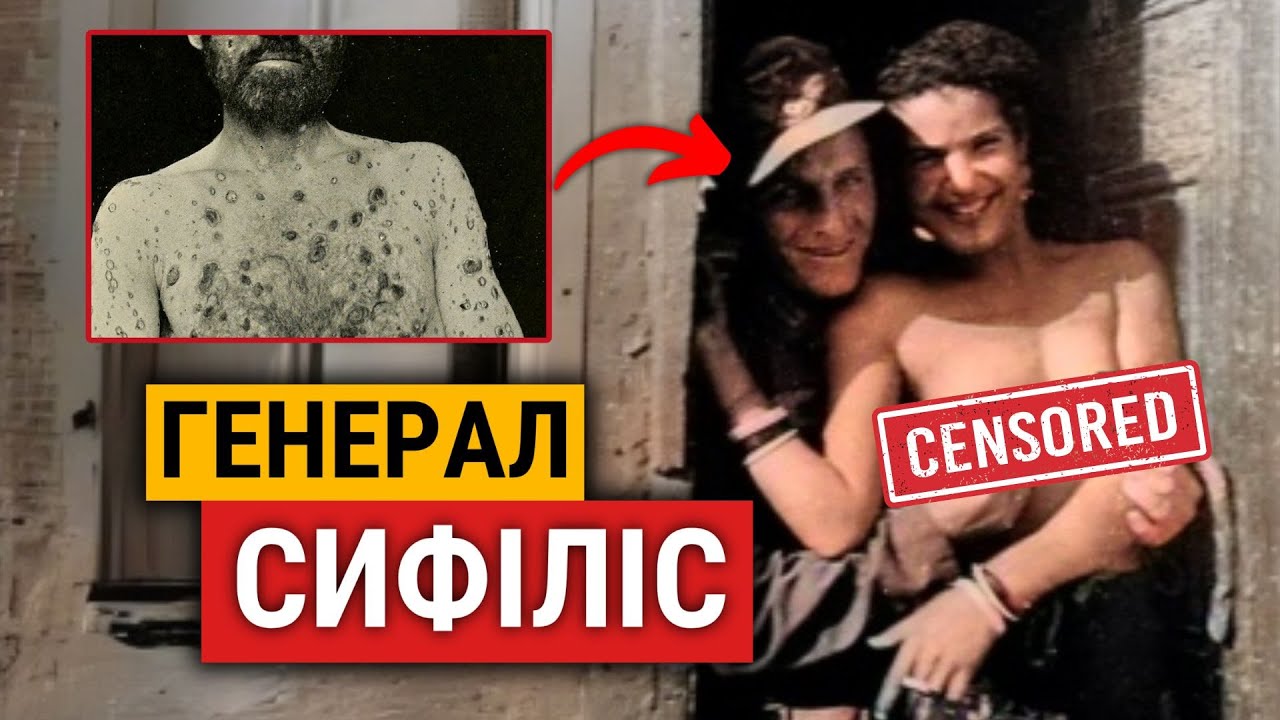 🔞СЕКС на ВІЙНІ: як ВЕНЕРИЧНІ хвороби руйнували БОЄЗДАТНІСТЬ армій
