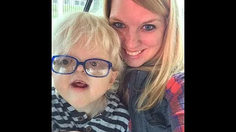 Cameron Elliott, Apert Syndrome