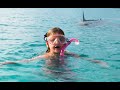 Shark attack bahamas girl thinks shark is a dolphin