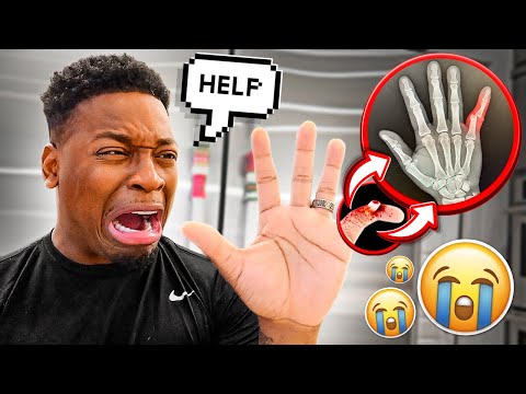 I BROKE MY HAND & GOT RUSHED TO THE HOSPITAL**FREAK ACCIDENT**