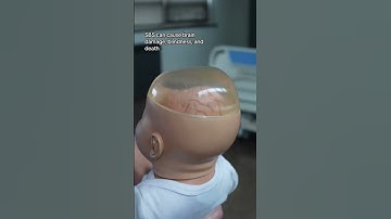 Why Shaking a Baby Can Be Deadly – Every Parent Needs to Hear This