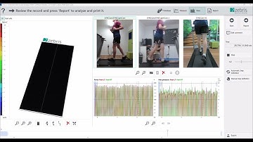 Zebris Gait Analysis System - short demo