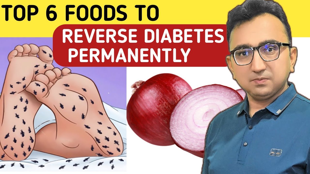 Top 6 Best Foods To Reverse Diabetes Permanently | Dr JK