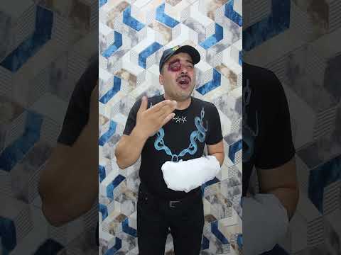 عيني واوا ايدي واوا 