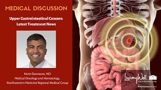 Upper GI Cancers: The Latest Treatment Options