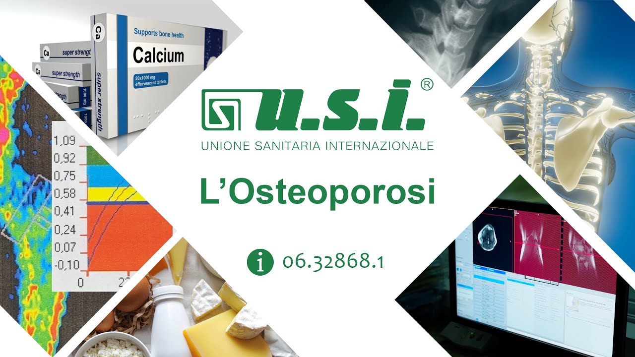Osteporosi- cos'è, come prevenire, curare e quale è il percorso ideale per una corretta diagnosi