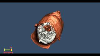 VTK Skull Reconstruction