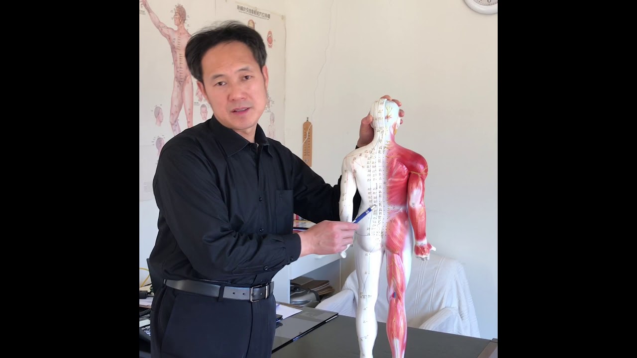 Acupuncture treat lower back pain.mov 