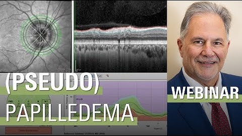 Differentiating Papilledema from Pseudopapilledema with OCT  | SPECTRALIS