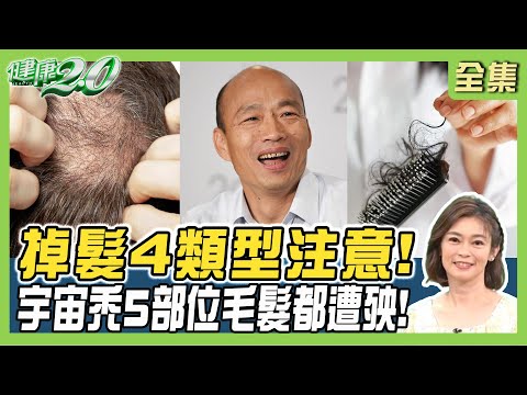 韓國瑜自嘲當院長2個月頭髮掉光!鋅補起來不再掉髮 4味神藥+1神拯救髮量! 健康2.0 20240511【完整版】鄭凱云 趙昭明 陳欣湄 陳峙嘉 許聖梅 雷議宗 @tvbshealth20