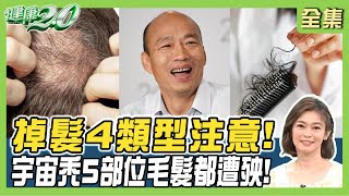 韓國瑜自嘲當院長2個月頭髮掉光!鋅補起來不再掉髮 4味神藥+1神拯救髮量! 健康2.0 20240511【完整版】鄭凱云 趙昭明 陳欣湄 陳峙嘉 許聖梅 雷議宗 @tvbshealth20