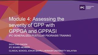 Module 4: Assessing the Severity of GPP with GPPGA and GPPASI