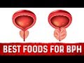 Best Foods For Benign Prostatic Hyperplasia (BPH) – Dr.Berg