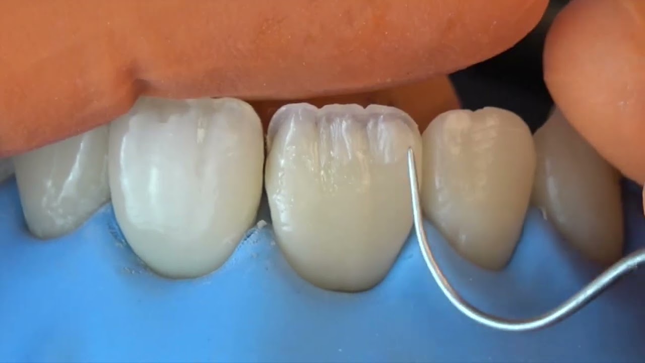 Polychromatic Layering technique