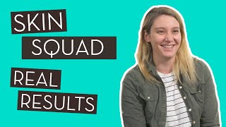 Skin Squad User Reviews | HUM Nutrition