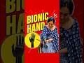 Bionic Hand Prosthesis | Myoelectric Artificial Hand | Bornlife India #naklihaat #artificialhand