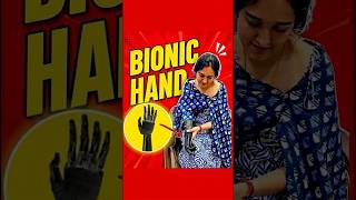 Bionic Hand Prosthesis | Myoelectric Artificial Hand | Bornlife India #naklihaat #artificialhand