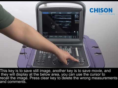 CHISON ECO6 Operation Training