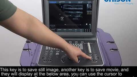 CHISON ECO6 Operation Training