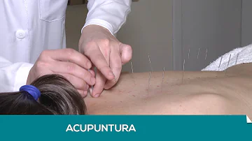 Como é feito acupuntura nas costas?