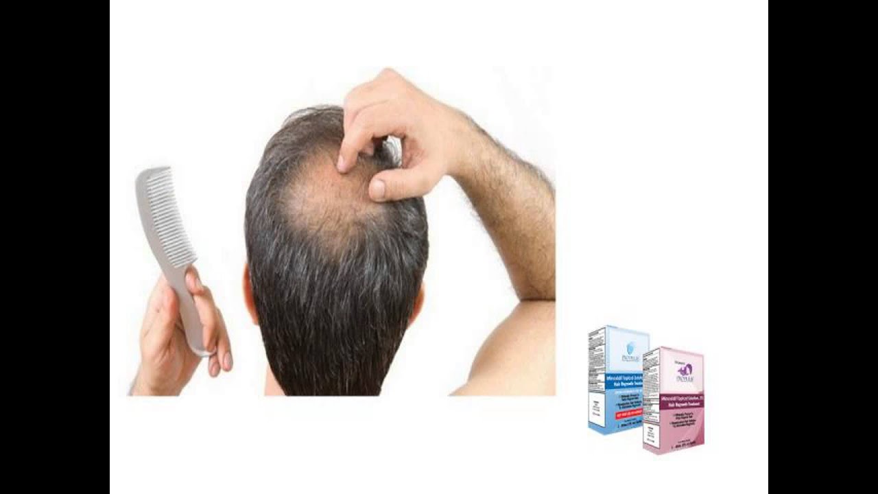 Causes Of Hair Loss