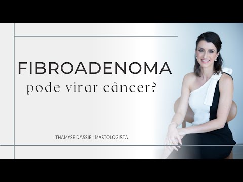 Vídeo: Os fibroadenomas aumentam o risco de câncer de mama?