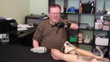 A $50 3D-Printed Prosthesis Compared to a $42,000 Myoelectric Prosthesis (3D Universe)