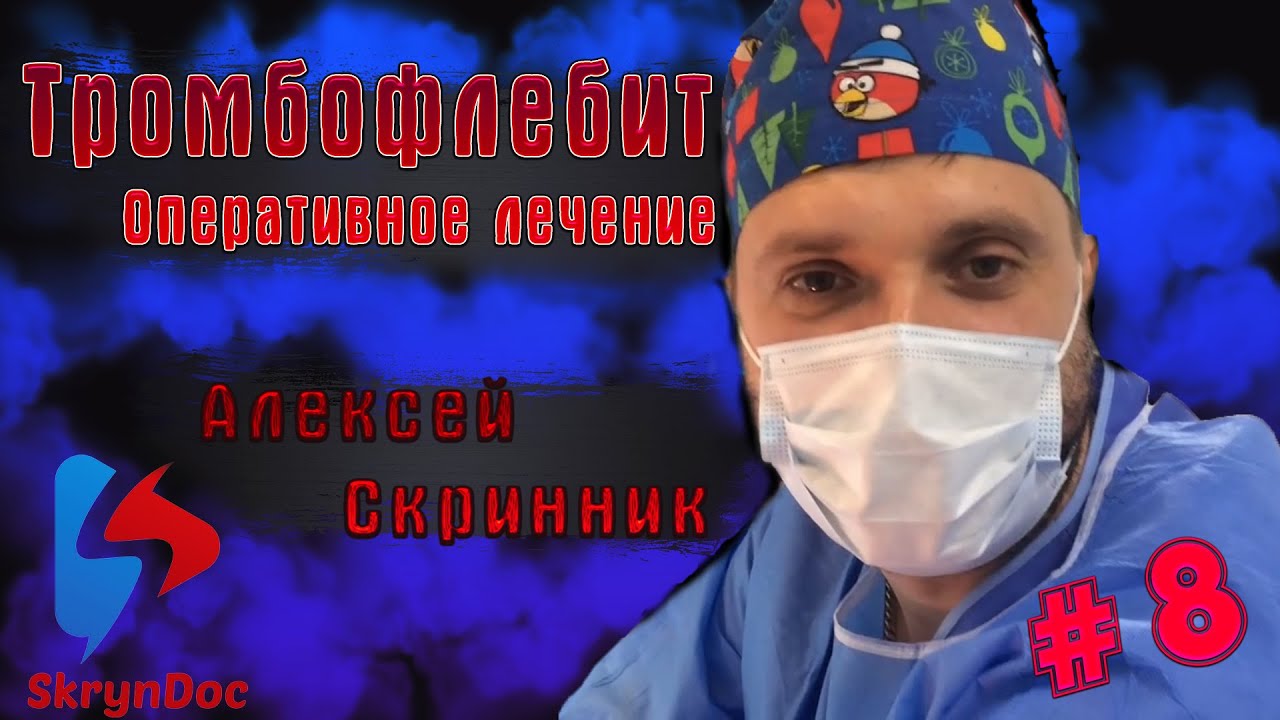 ТРОМБОЗ. Оперативное лечение острого тромбофлебита! ✌️