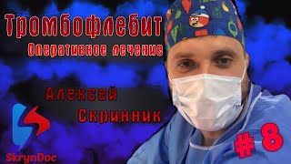 ТРОМБОЗ. Оперативное лечение острого тромбофлебита! ✌️