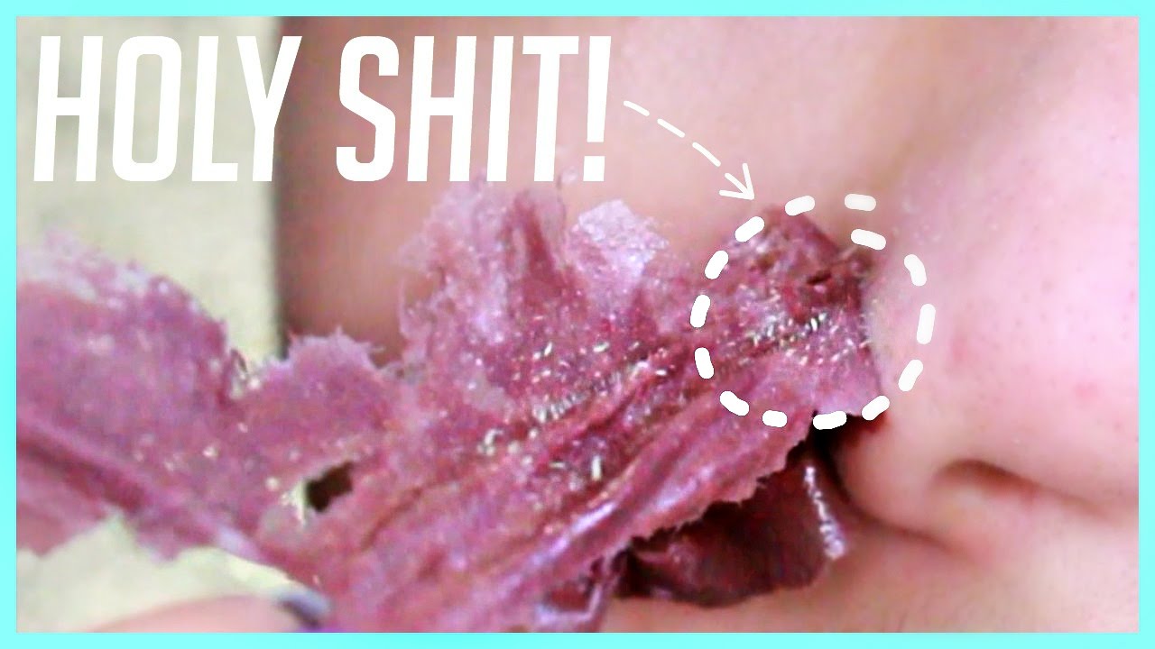 BEST Peel Off Mask for TEENAGERS!