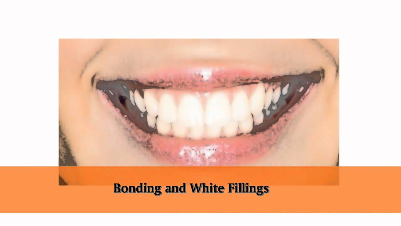 Bronx Dentist Affordable Dental Implants & Cosmetic Dentistry in