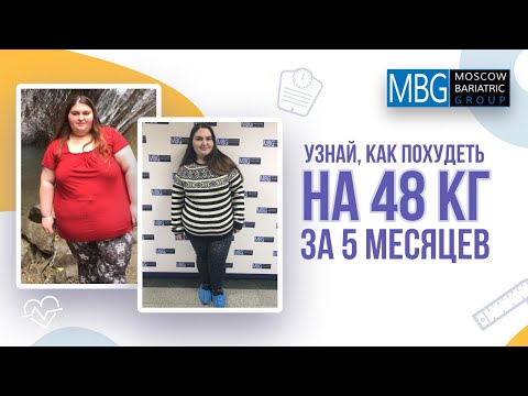 Минус 48 кг за 5 месяцев | Отзыв после уменьшения желудка