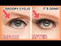 Get Rid of Droopy Eyelid, Eye Wrinkles Naturally | Make Your Eyes Bigger