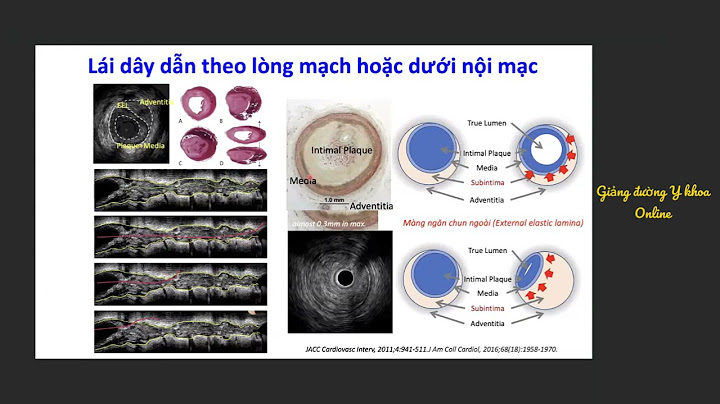 Cách tính đánh giá sau can thiệp