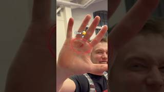 My Hand Ripped From All The Weight