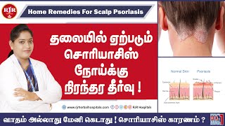 தலையில் ஏற்படும் தோல் நோய்க்கு நிரந்தர தீர்வு ! Scalp psoriasis ~ RJR Hospitals