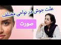 علت جوش زدن در نواحی مختلف صورت ۲۵ فوریه ۲۰۲۵