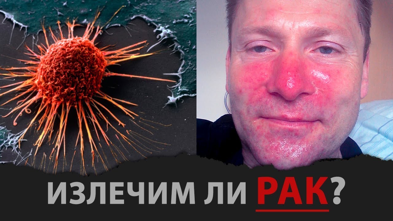 Излечим ли Рак? За гранью возможного - YouTube