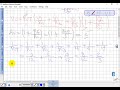 13-مثال Summing Amplifier (Non-Inverting)
