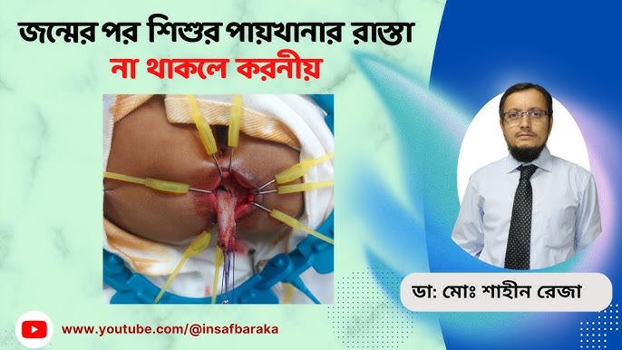 Katta kokrakli etuk ayollar Torrent porno kuzatuvchilar