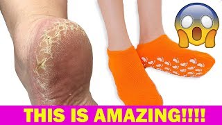 CRAZY GEL SPA SOCKS  FOR CRACKED HEELS (AMAZING RESULTS)