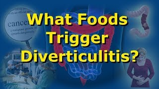 What Foods Trigger Diverticulitis?