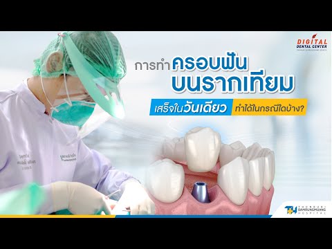 การทำครอบฟันบนรากเทียมเสร็จในวันเดียว ทำได้ในกรณีใดบ้าง  |   