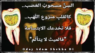 الموت على قيد الحياة - حياة مسحوبة العصب - Oday Adam Shekha Di