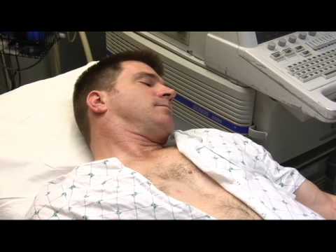 Video: Stress-echocardiografie: Doel, Procedure En Resultaten