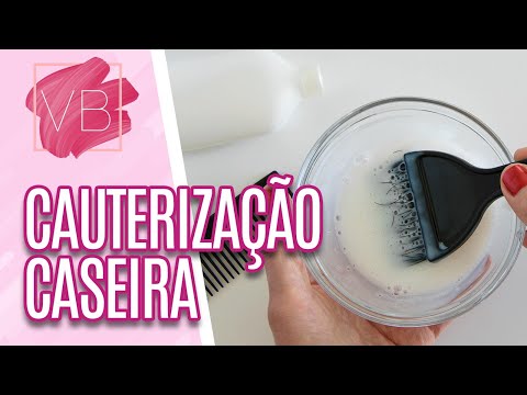 Vídeo: Você capitaliza nitinol?