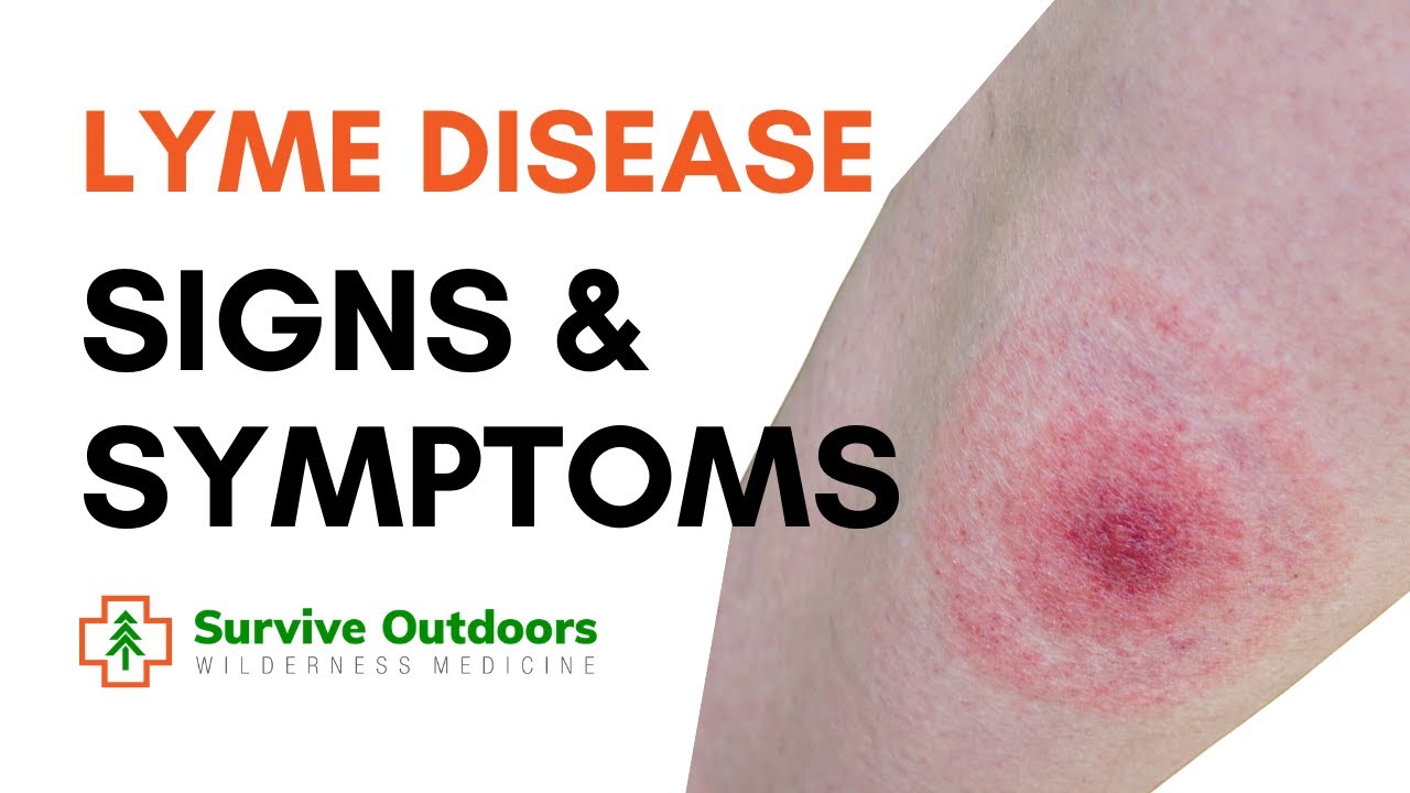 What are the Symptoms of Lyme Disease? YouTube