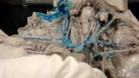 Cardiovascular system - pig dissection 4