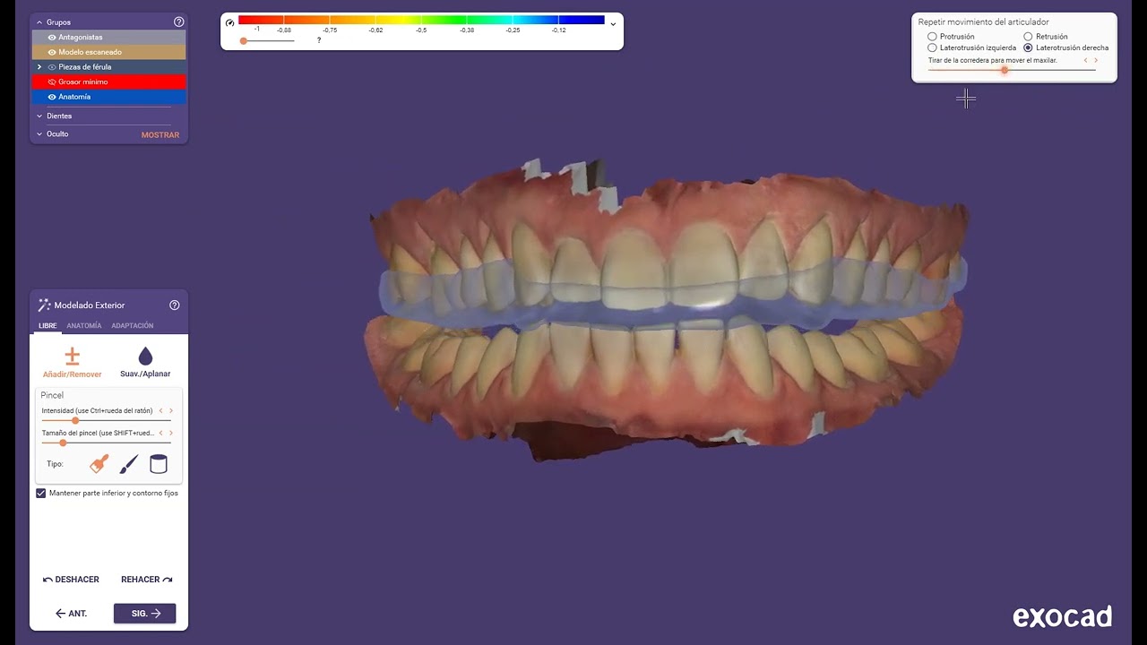 Férula de descarga para el día alivia la tensión muscular, Férulas Dentales  .NET - Cuidado y Salud Bucal